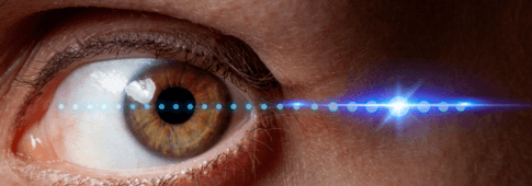 EMDR